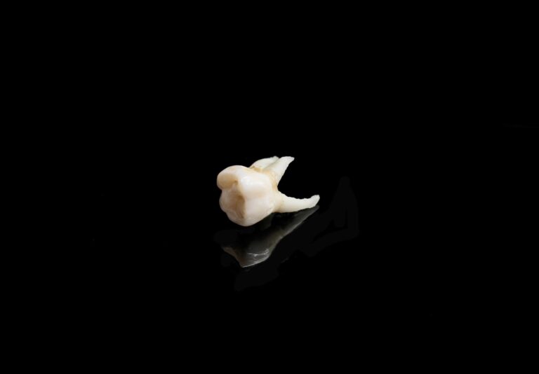 A single molar tooth sits on a reflective black surface, showcasing its detailed anatomy with multiple cusps and visible roots. The high-contrast background emphasizes the tooth’s structure, making it ideal for educational or dental reference purposes.