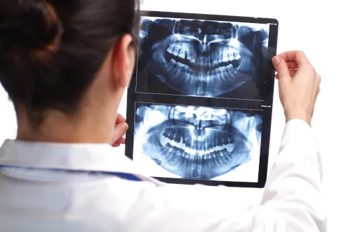 AI-assisted dental X-rays at South Arlington Smiles in Arlington, TX